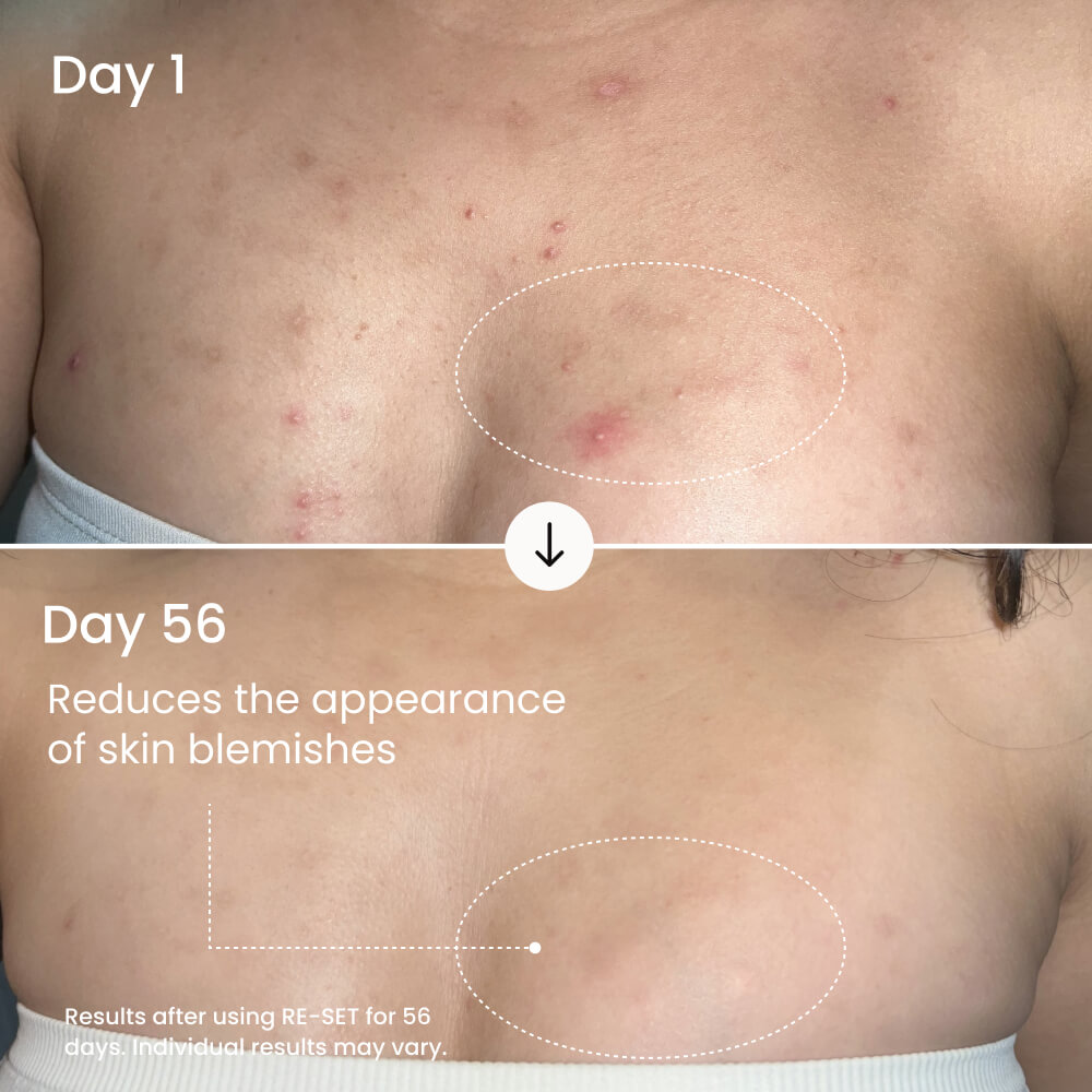 Balancing Body Serum product